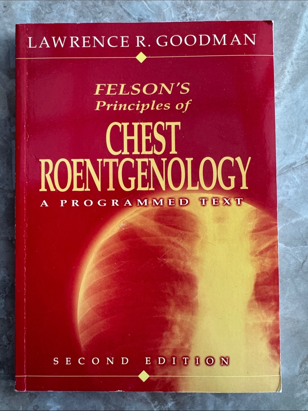 Felson's Principles of Chest Roentgenology 2nd Edition by Lawrence Goodman
